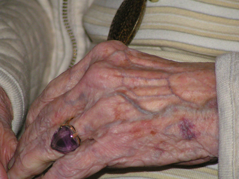 Elderly woman's ring